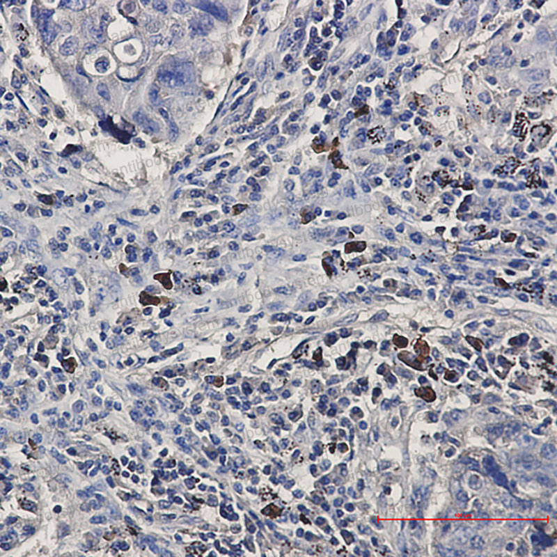 Anti-BNIP3L Antibody (R1E46)