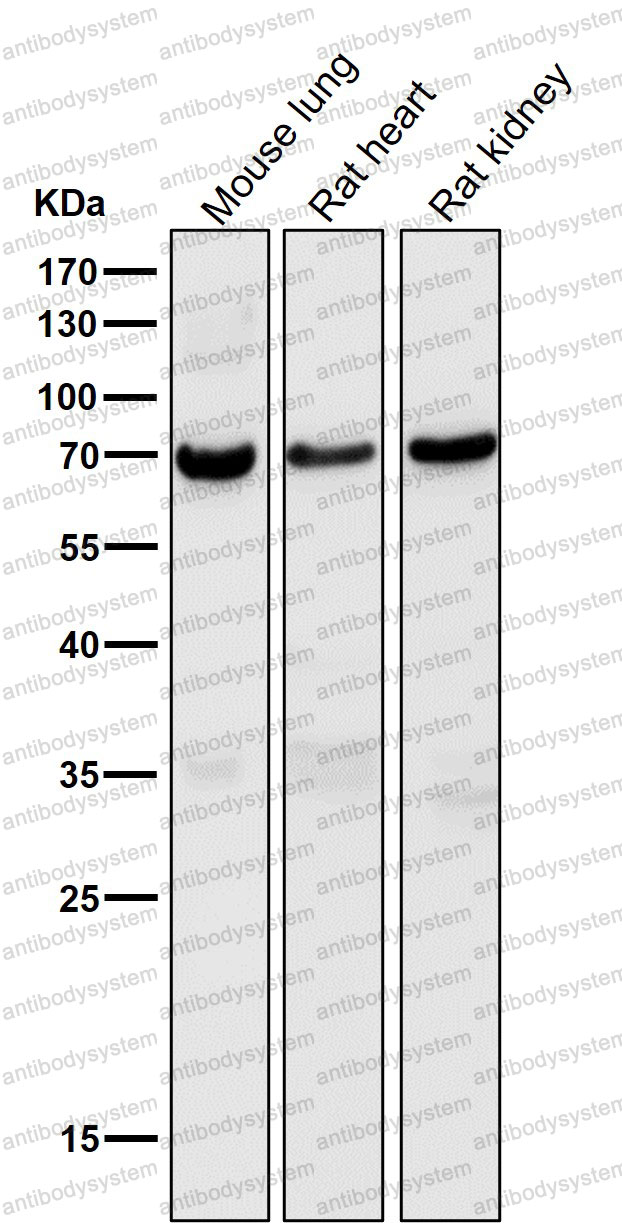 Anti-PLIN1 Antibody (R1E47)
