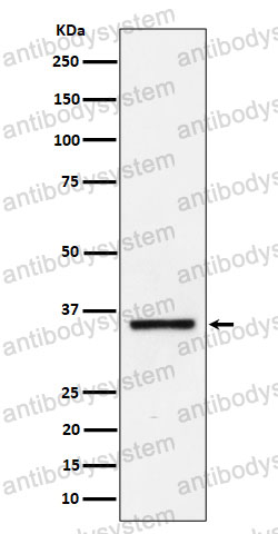 Anti-KLK8 Antibody (R1E48)