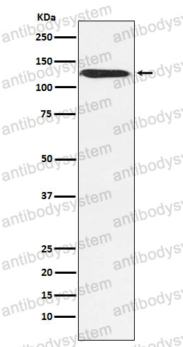 Anti-SMARCA5 Antibody (R1E49)