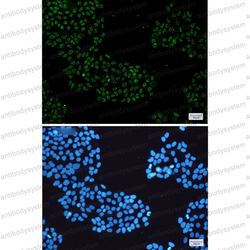 Anti-KDM1A Antibody (R1E53)
