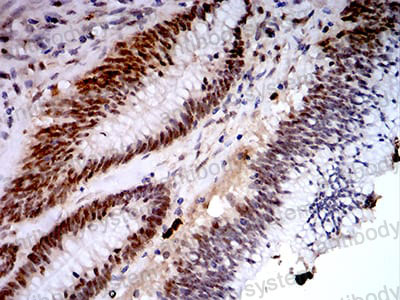 Immunohistochemical for Anti-KDM1A Antibody (R2V20) ?>