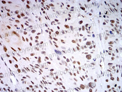 Immunohistochemical for Anti-KDM1A Antibody (R2V20) ?>
