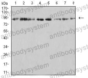 Western blot for Anti-KDM1A Antibody (R2V20) ?>