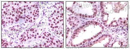 Immunohistochemical for Anti-KDM1A Antibody (R2V17) ?>
