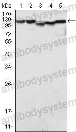 Western blot for Anti-KDM1A Antibody (R2V17) ?>