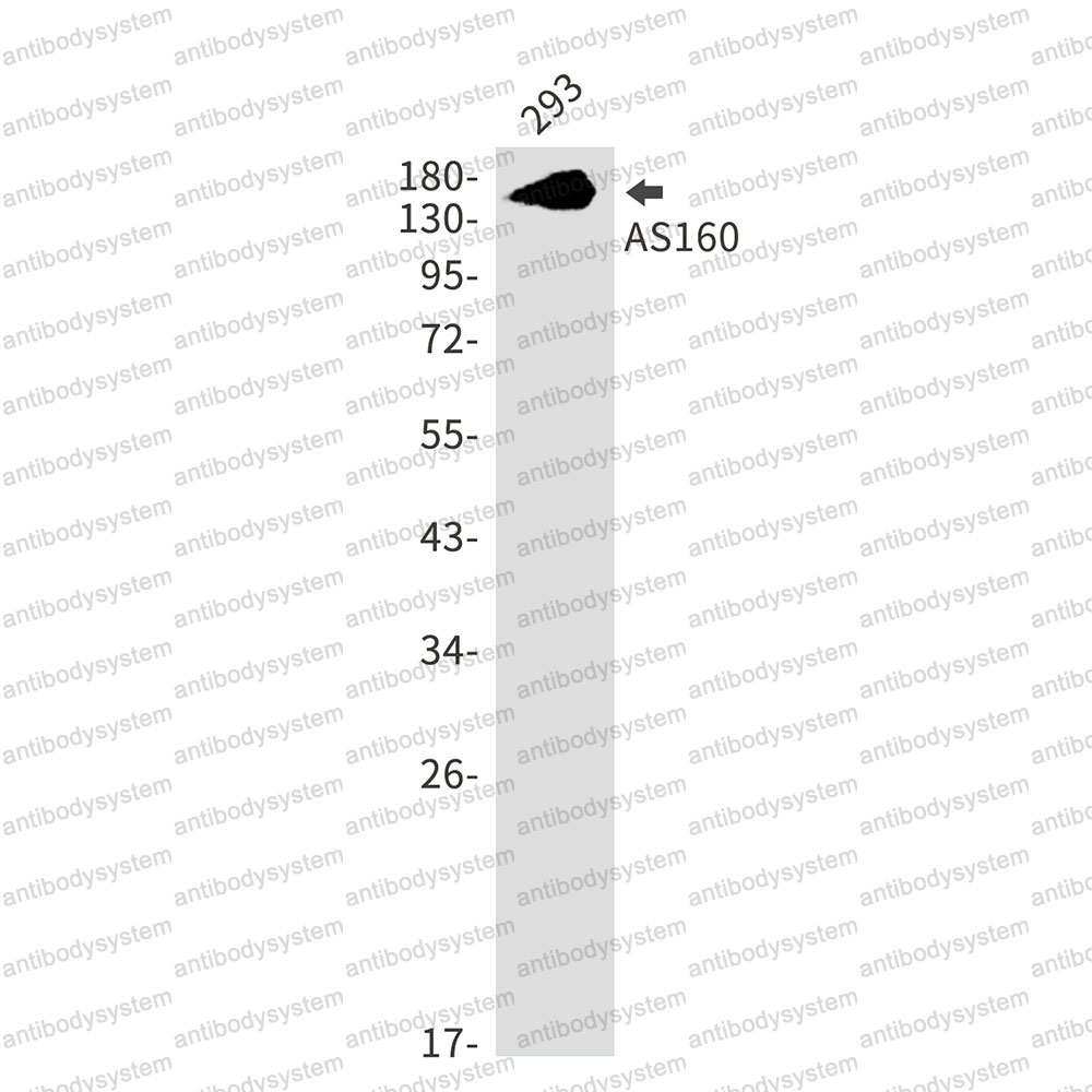 Anti-TBC1D4 Antibody (R1E54)