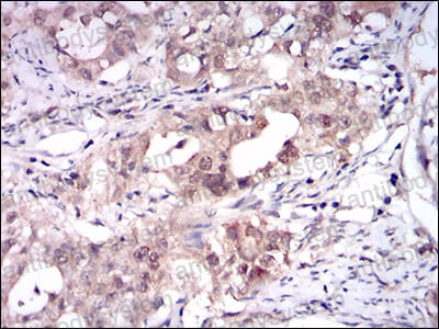 Immunohistochemical for Anti-ONECUT3 Antibody (R2V24) ?>