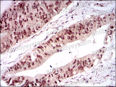 Immunohistochemical for Anti-ONECUT3 Antibody (R2V24) ?>