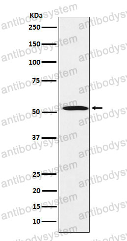 Anti-FADS1/Delta 5 desaturase Antibody (R1E55)