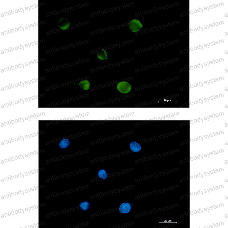 Anti-FADS1/Delta 5 desaturase Antibody (R1E56)