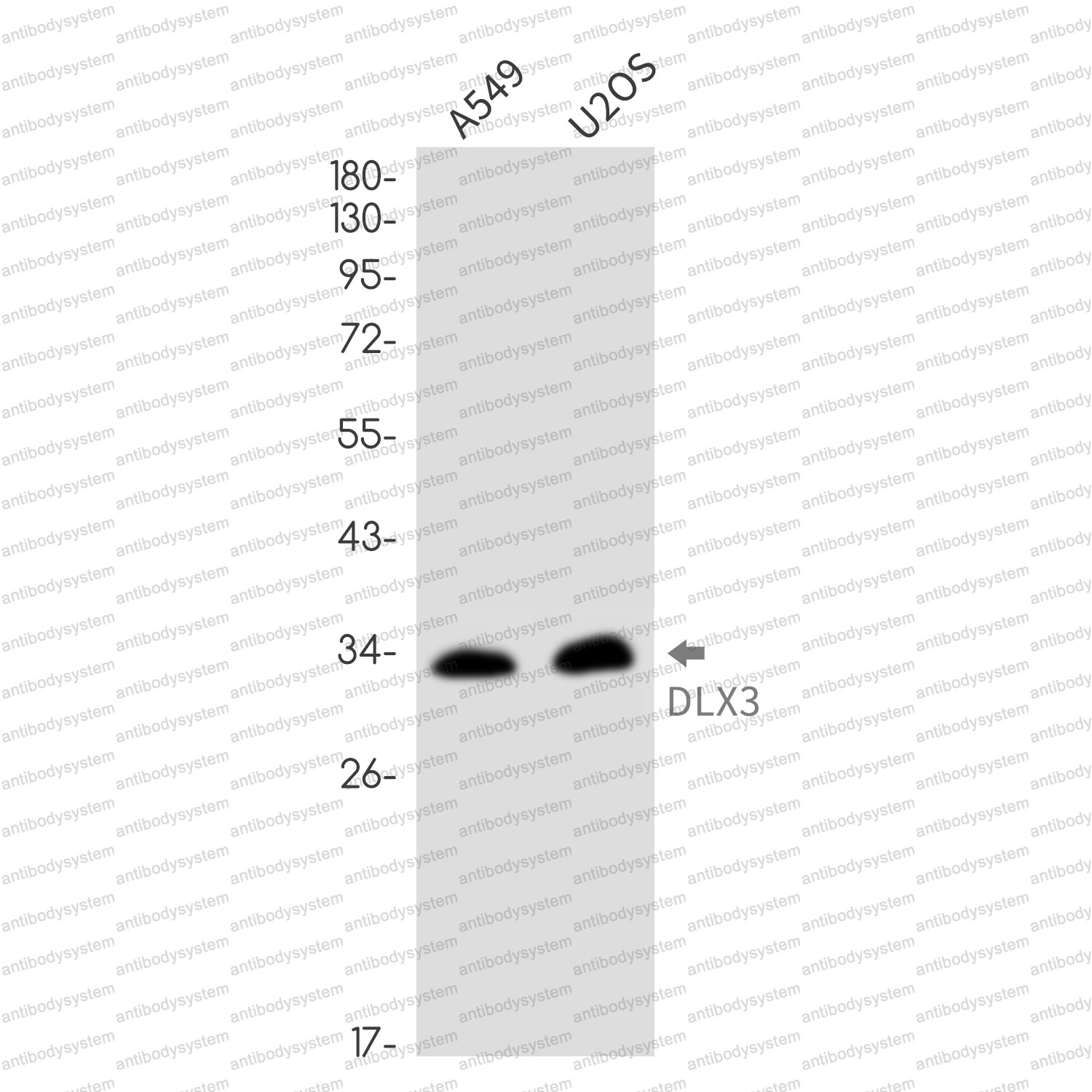 Anti-DLX3 Antibody (R1E60)