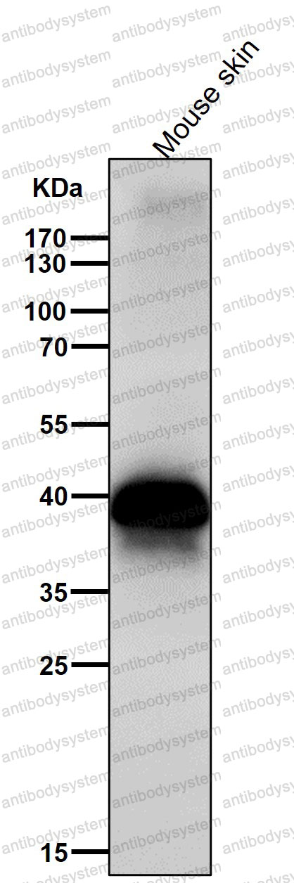 Anti-DLX3 Antibody (R1E59)