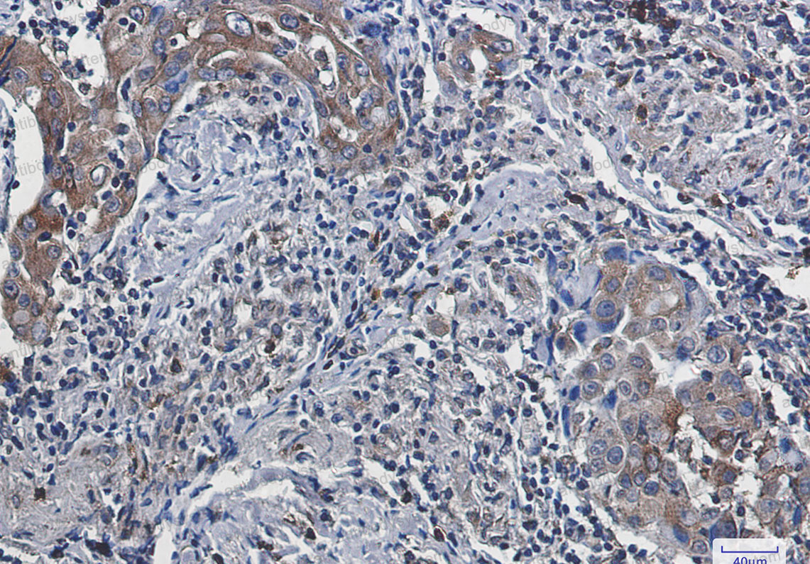 Anti-ACSL4 Antibody (R1E62)