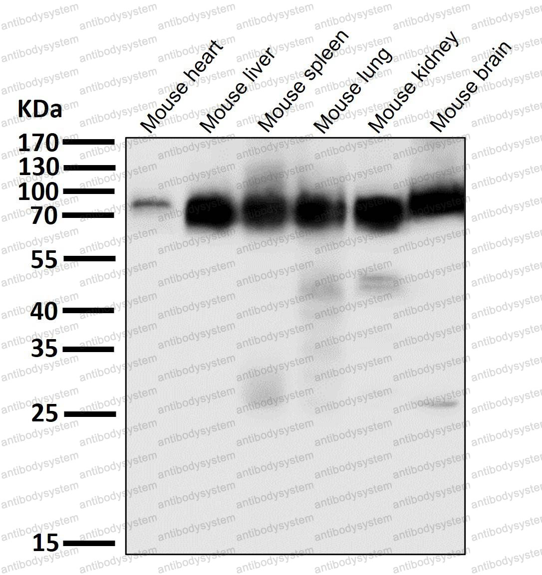 Anti-ACSL4 Antibody (R1E61)