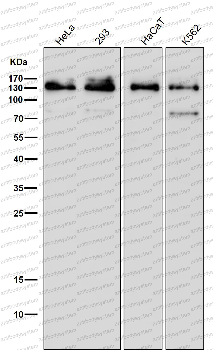 Anti-OGA Antibody (R1E63)