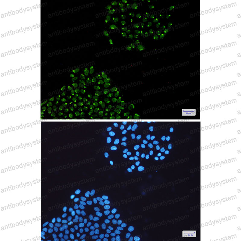 Anti-SYNCRIP Antibody (R1E65)