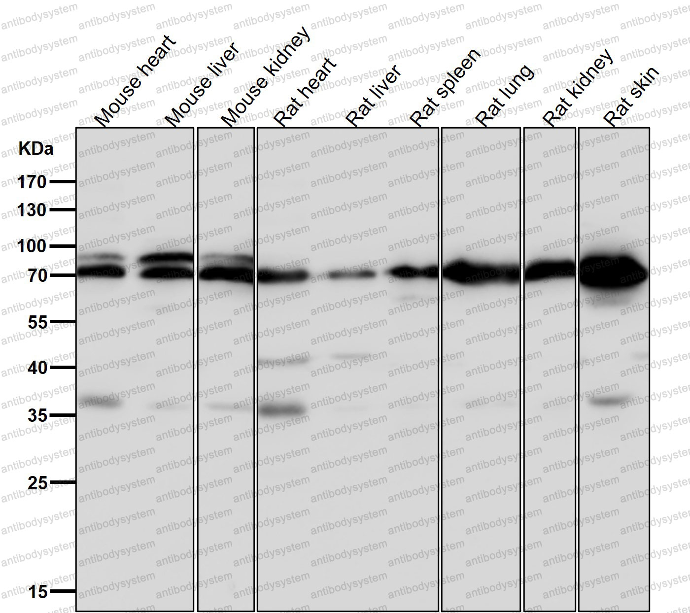 Anti-SYNCRIP Antibody (R1E64)