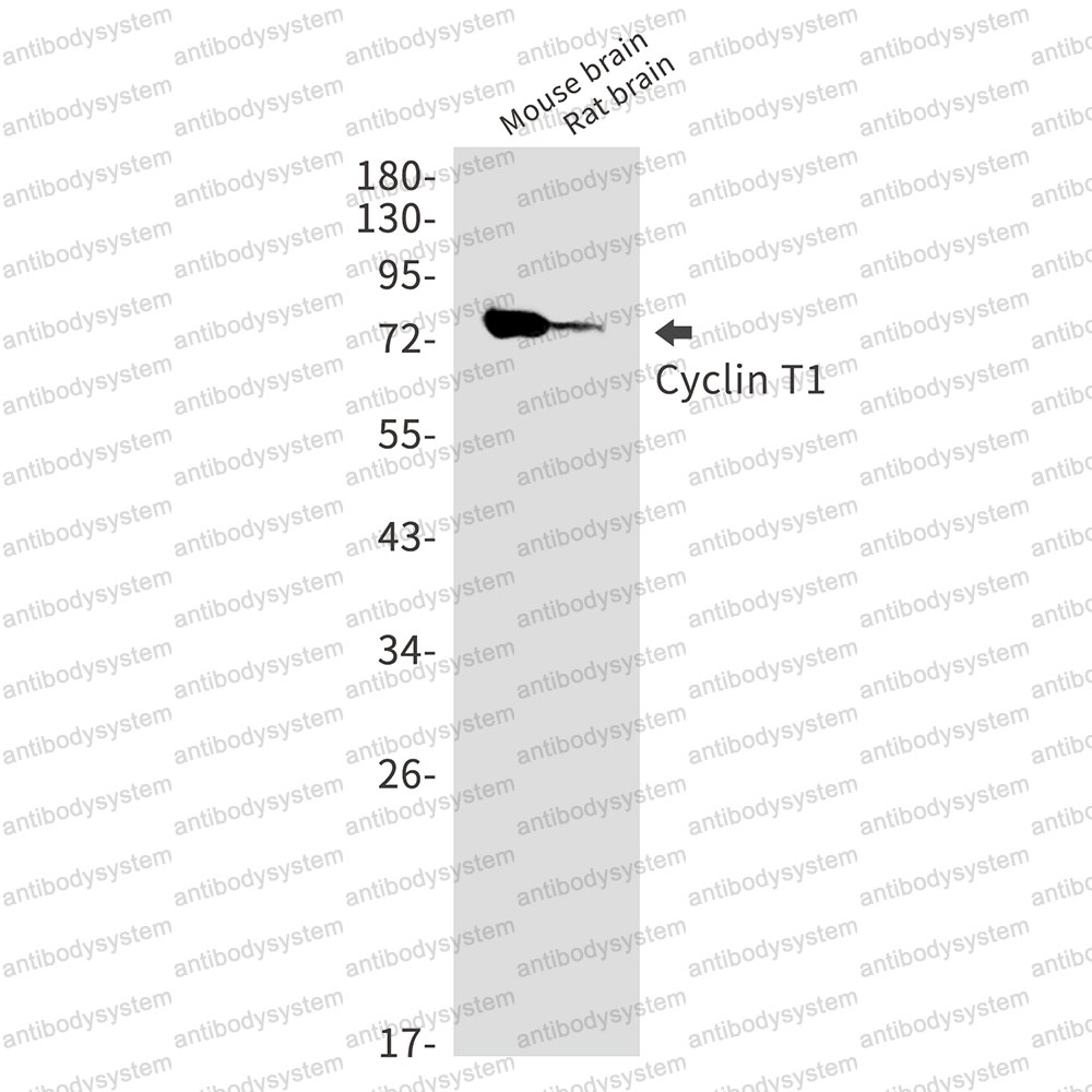 Anti-CCNT1 Antibody (R1E67)