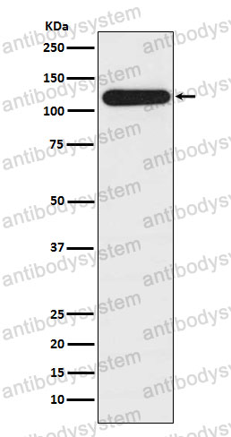 Anti-BUB1B Antibody (R1E68)