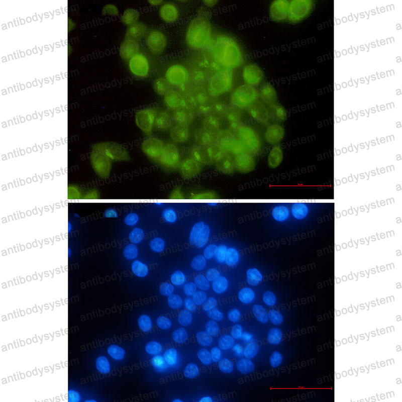 Anti-BUB1B Antibody (R1E69)