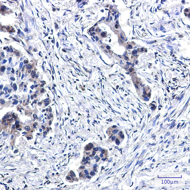Anti-BUB1B Antibody (R1E70)