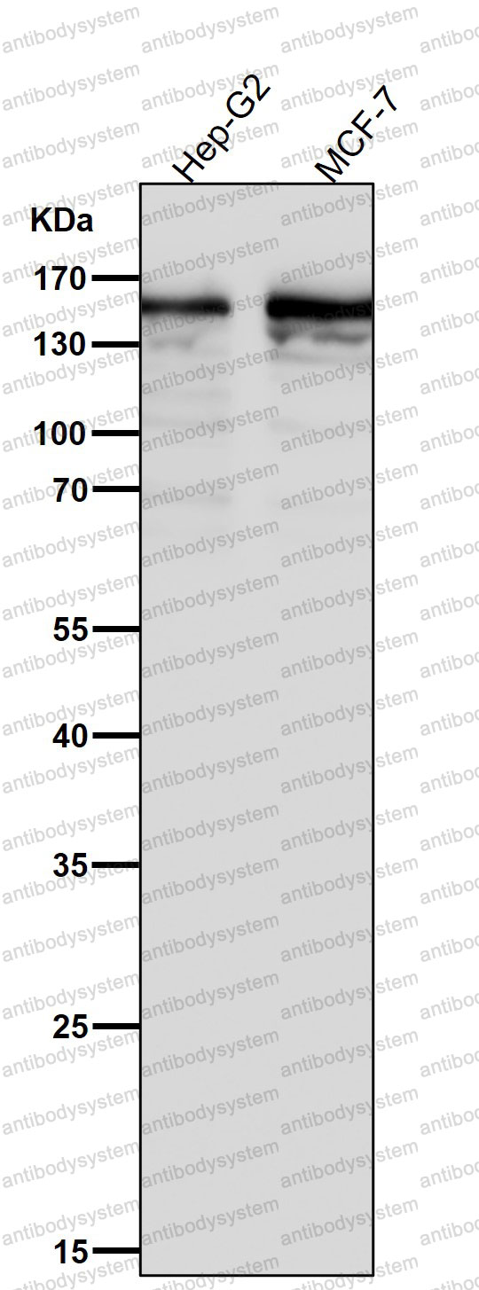 Anti-DIAPH1 Antibody (R1E73)