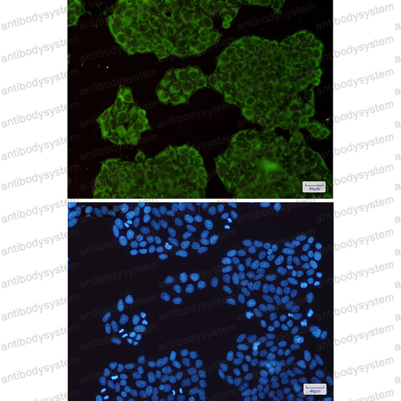 Anti-EXOC3 Antibody (R1E76)