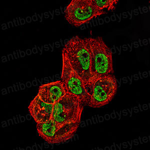 Immunofluorescence for Anti-PLIN3 Antibody (R2V33) ?>
