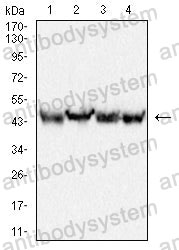 Western blot for Anti-PLIN3 Antibody (R2V33) ?>