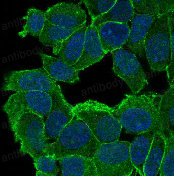 Anti-CTNND1 Antibody (R1A20)