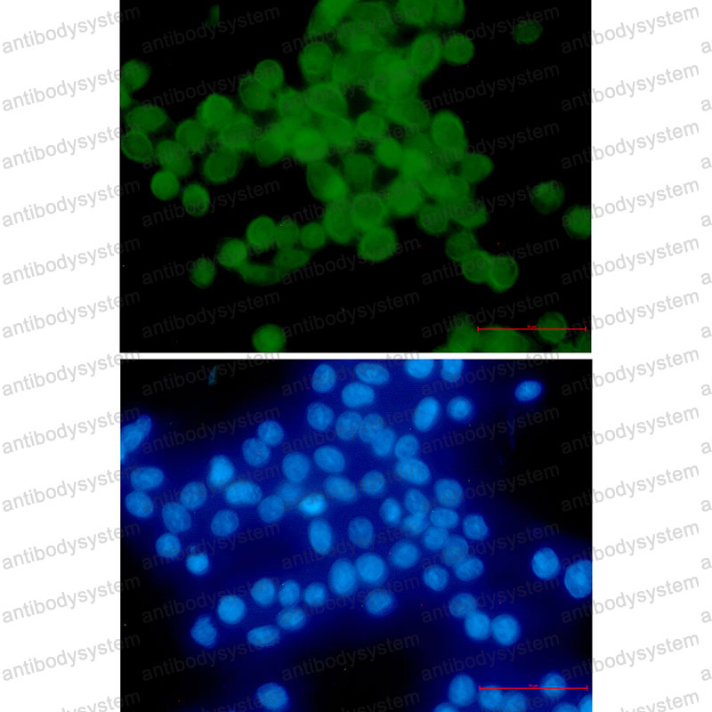 Anti-Phospho-CTNND1 (Thr916) Antibody (R1E82)
