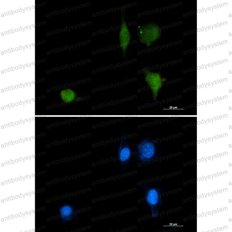 Anti-Phospho-CTNND1 (Tyr228) Antibody (R1E80)