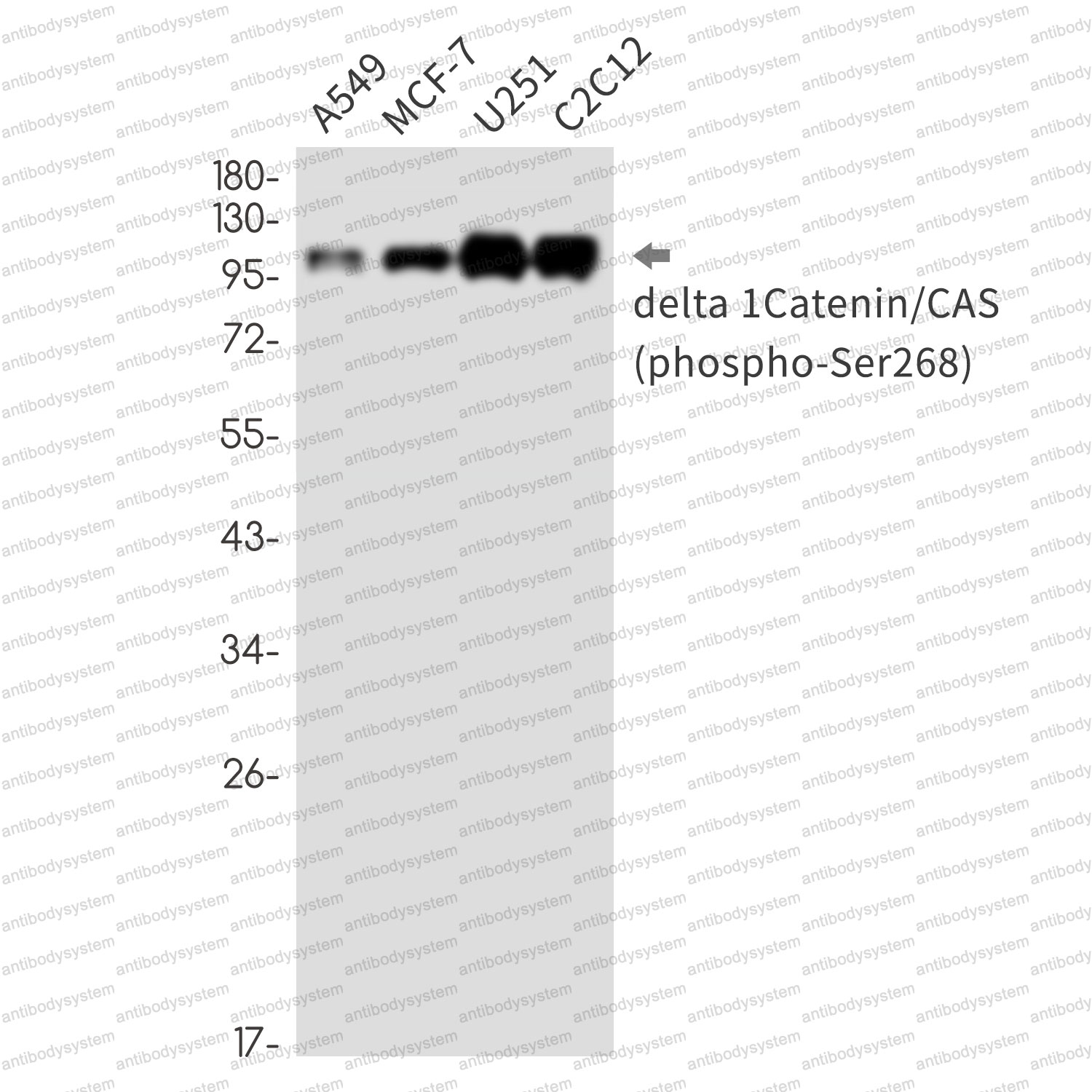 Anti-Phospho-CTNND1 (Ser268) Antibody (R1E81)
