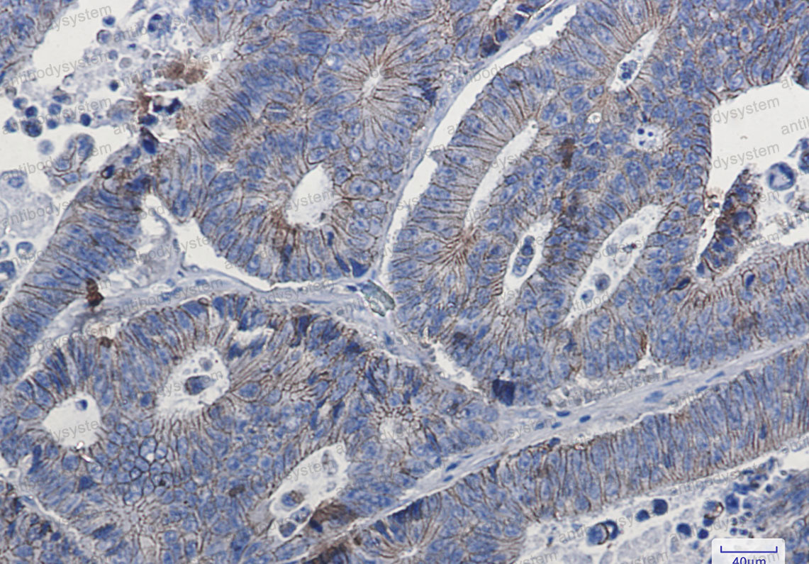 Anti-CTNND1 Antibody (R1E83)