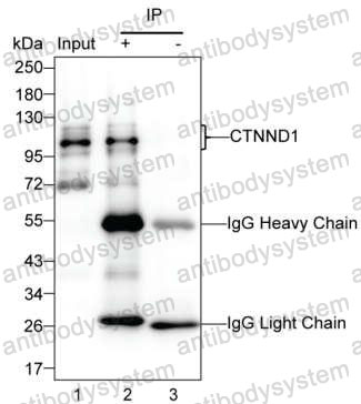 Immunoprecipitation for Anti-CTNND1 Antibody (R2V39) ?>