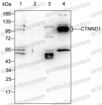 Western blot for Anti-CTNND1 Antibody (R2V39) ?>