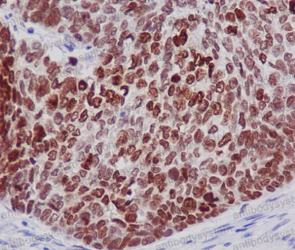 Anti-Histone H2B Antibody (R1E86)