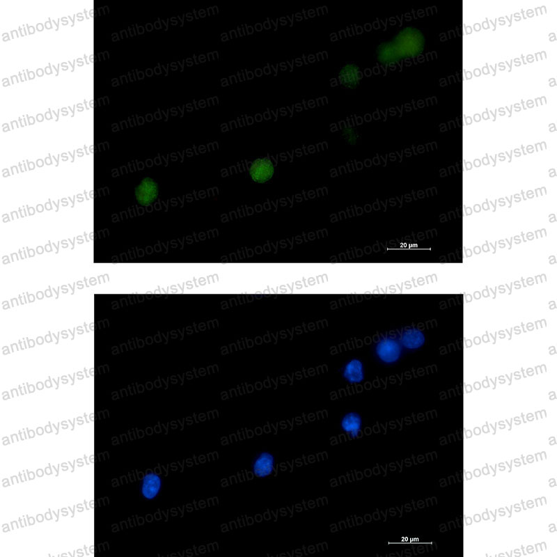 Anti-DKC1 Antibody (R1E89)