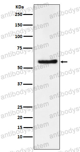 Anti-DKC1 Antibody (R1E88)
