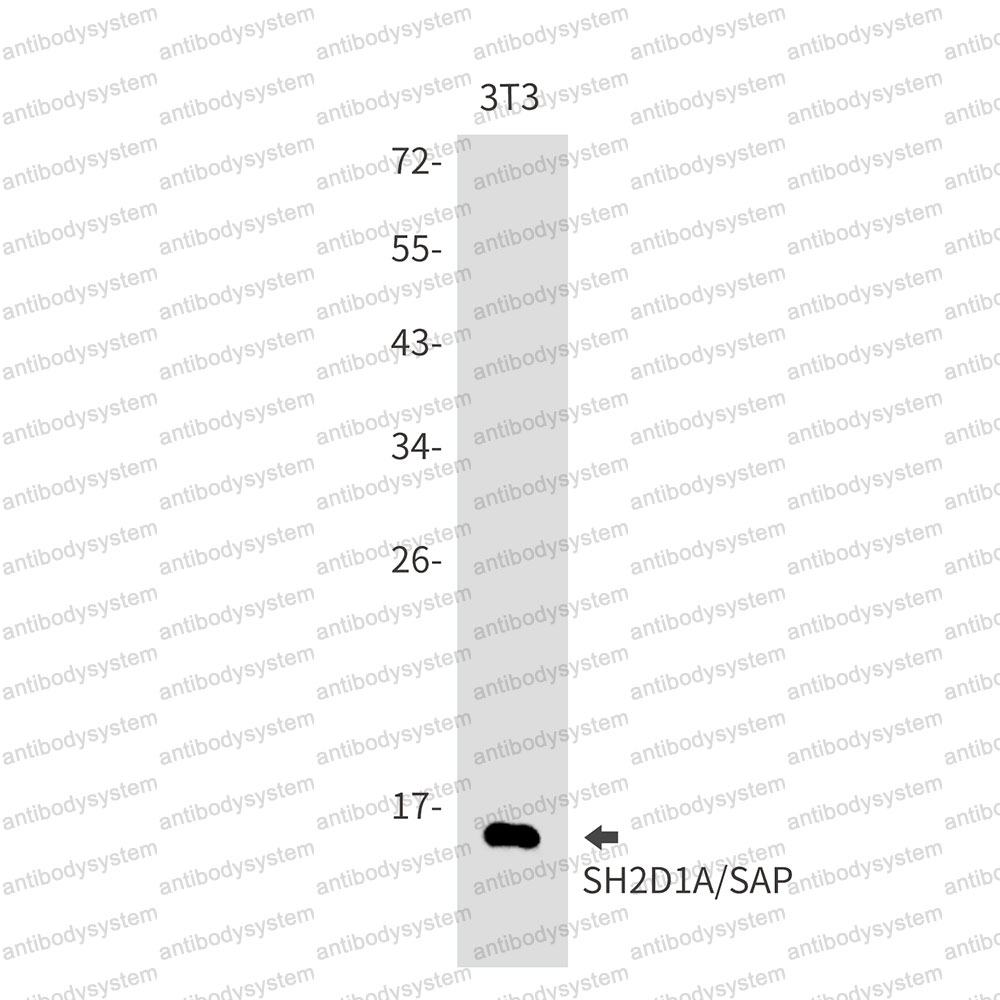 Anti-SH2D1A Antibody (R1E90)