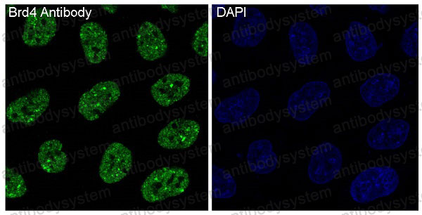 Anti-BRD4 Antibody (R1B66)
