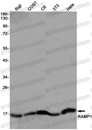 Anti-RAMP1 Antibody (R1E91)