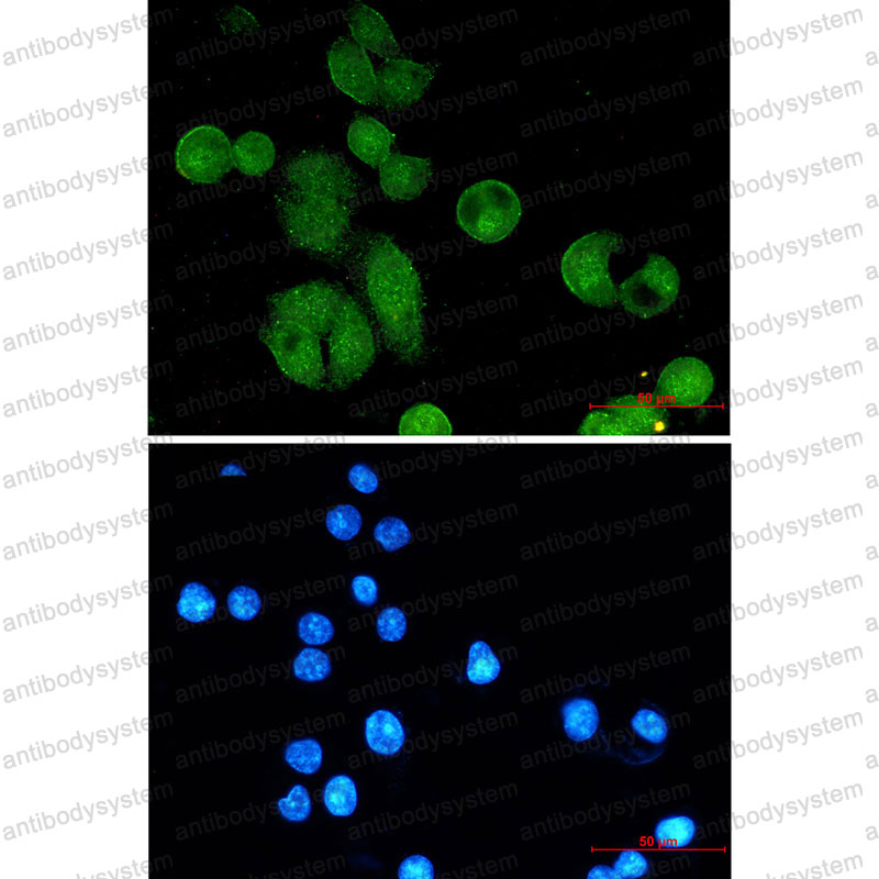 Anti-NBN Antibody (R1E92)