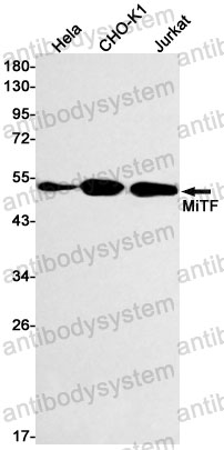 Anti-MITF Antibody (R1E95)