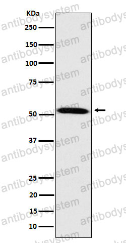 Anti-FKTN Antibody (R1E98)