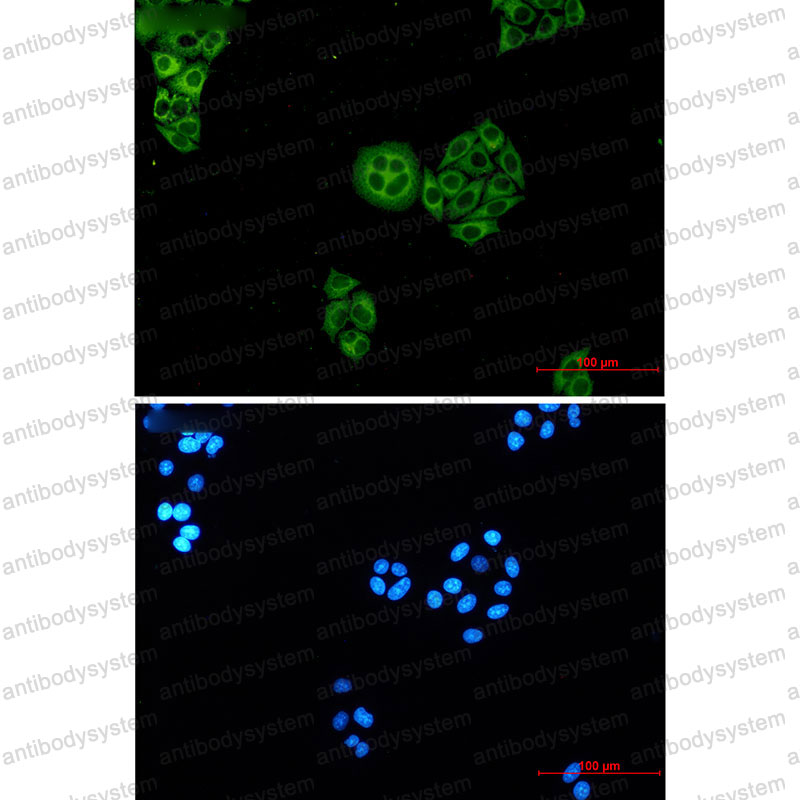 Anti-WDR1 Antibody (R1F01)