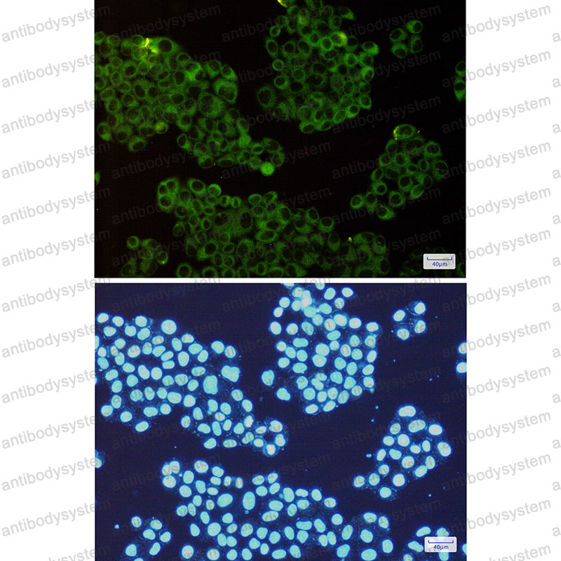 Anti-ROCK2 Antibody (R1F05)