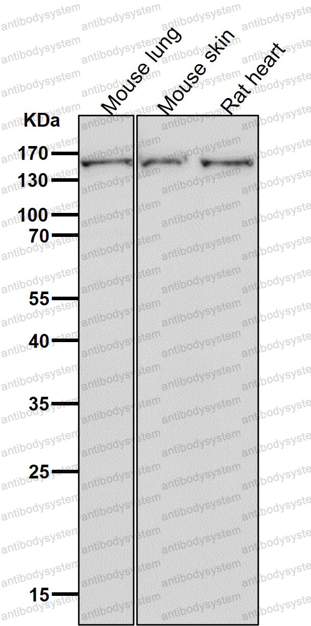Anti-ROCK2 Antibody (R1F04)