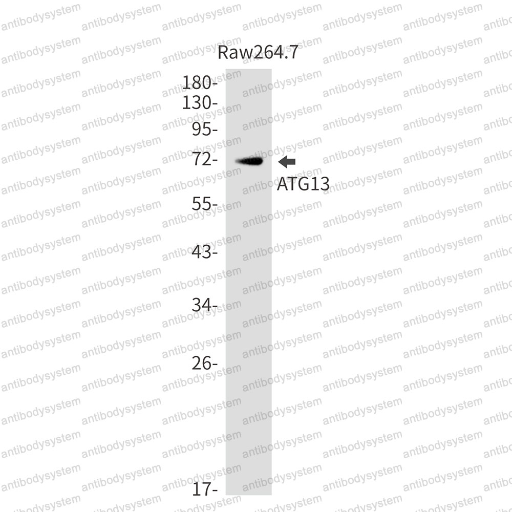 Anti-ATG13 Antibody (R1F06)